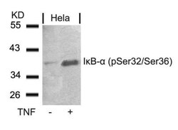 IkB-alpha, p Ser32, p Ser36 Antibody, Novus Biologicals 0.025 mL; Unconjugated:Antibodies,